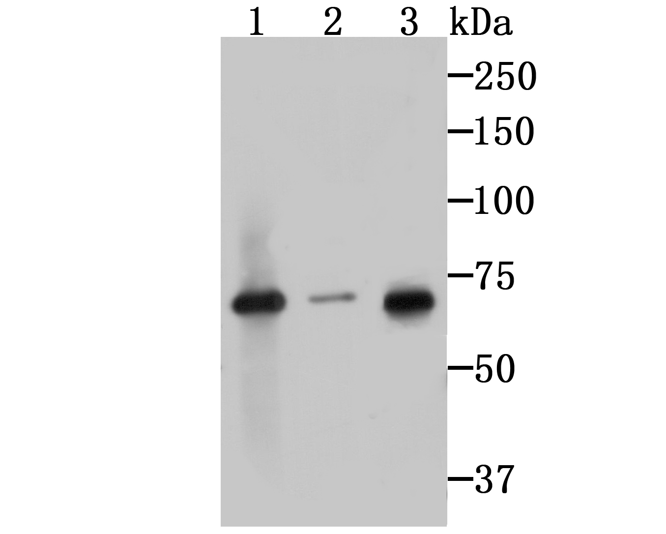 IRAK2 Rabbit mAb