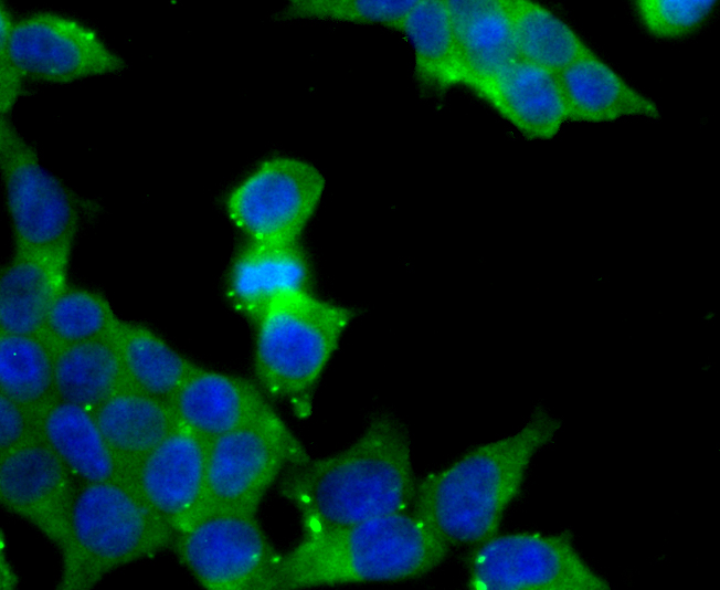 Cellubrevin Rabbit mAb