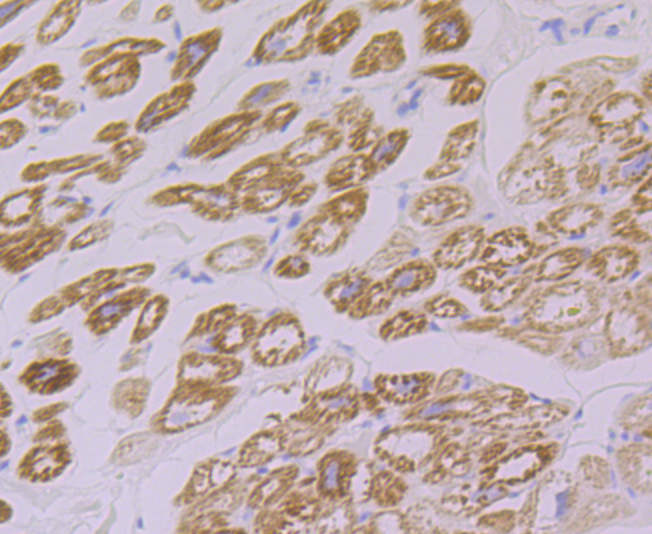 FHL2 Rabbit mAb