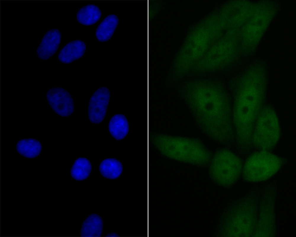 p53 DINP1 Rabbit mAb