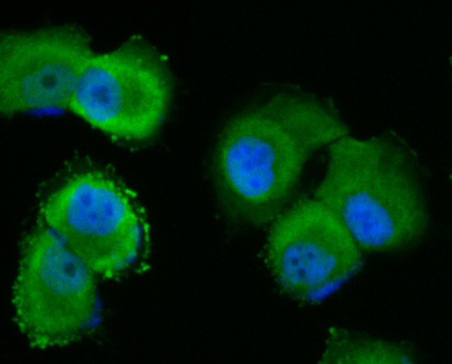 p53 DINP1 Rabbit mAb