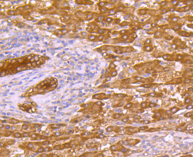 p53 DINP1 Rabbit mAb