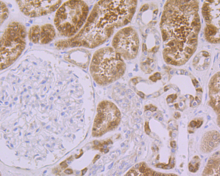 p53 DINP1 Rabbit mAb