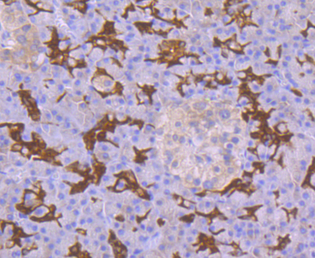 p53 DINP1 Rabbit mAb