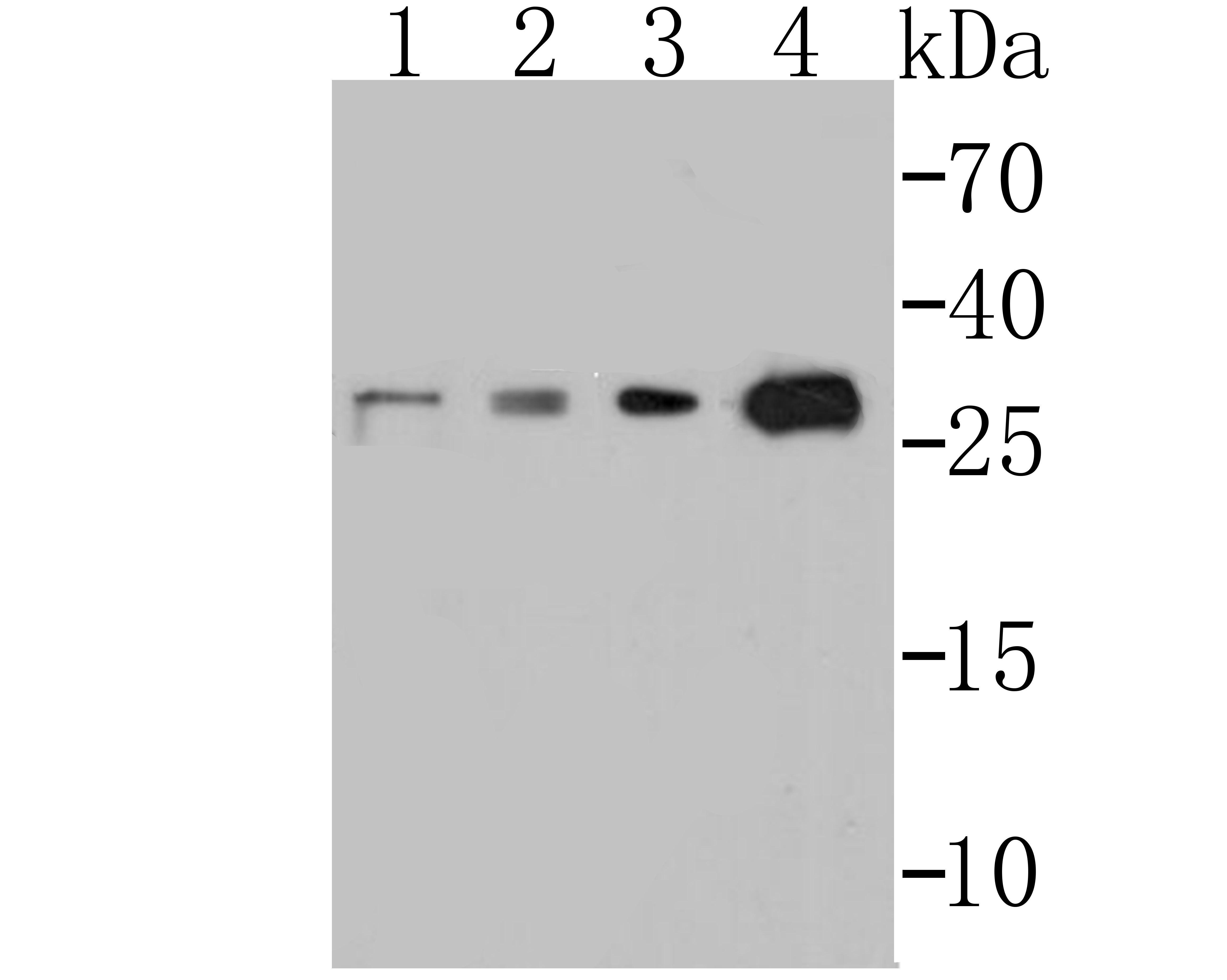 p53 DINP1 Rabbit mAb