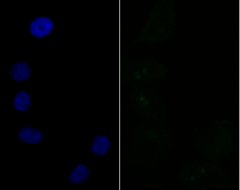 SF3B3 Rabbit mAb