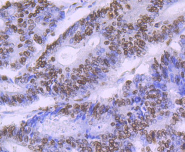 SF3B3 Rabbit mAb