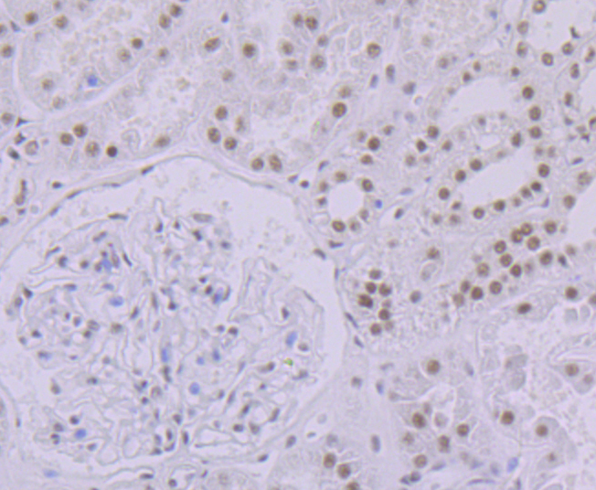 SF3B3 Rabbit mAb