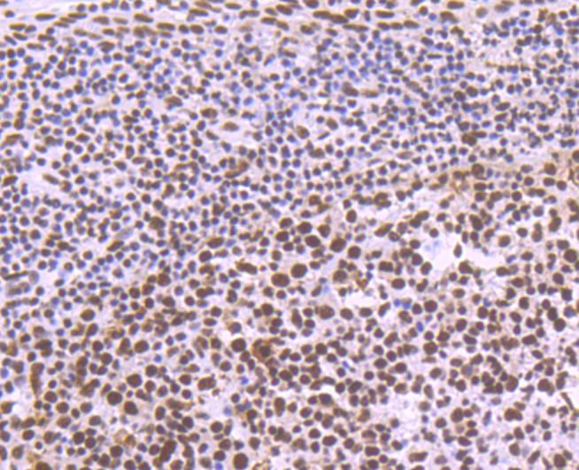 SF3B3 Rabbit mAb