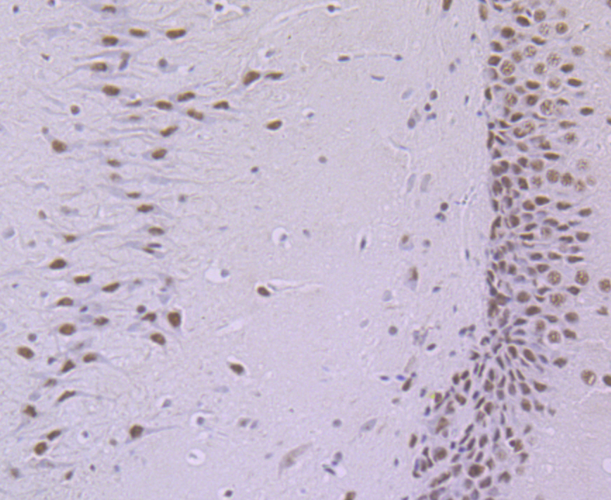 SF3B3 Rabbit mAb