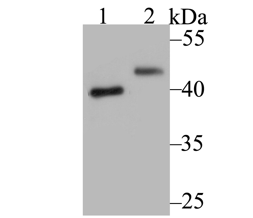 SUV39H2 Rabbit mAb