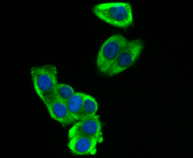 SOCS2 Rabbit mAb