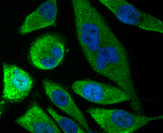 SOCS2 Rabbit mAb