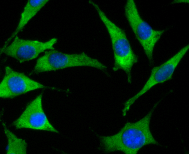 SOCS2 Rabbit mAb