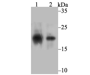 SOCS2 Rabbit mAb