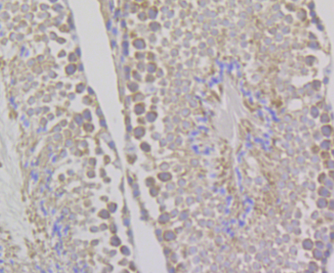 WNK1 Rabbit mAb