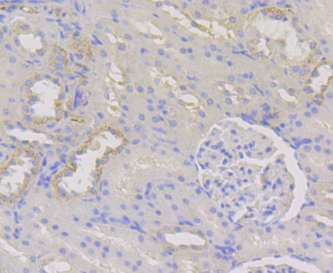 WNK1 Rabbit mAb