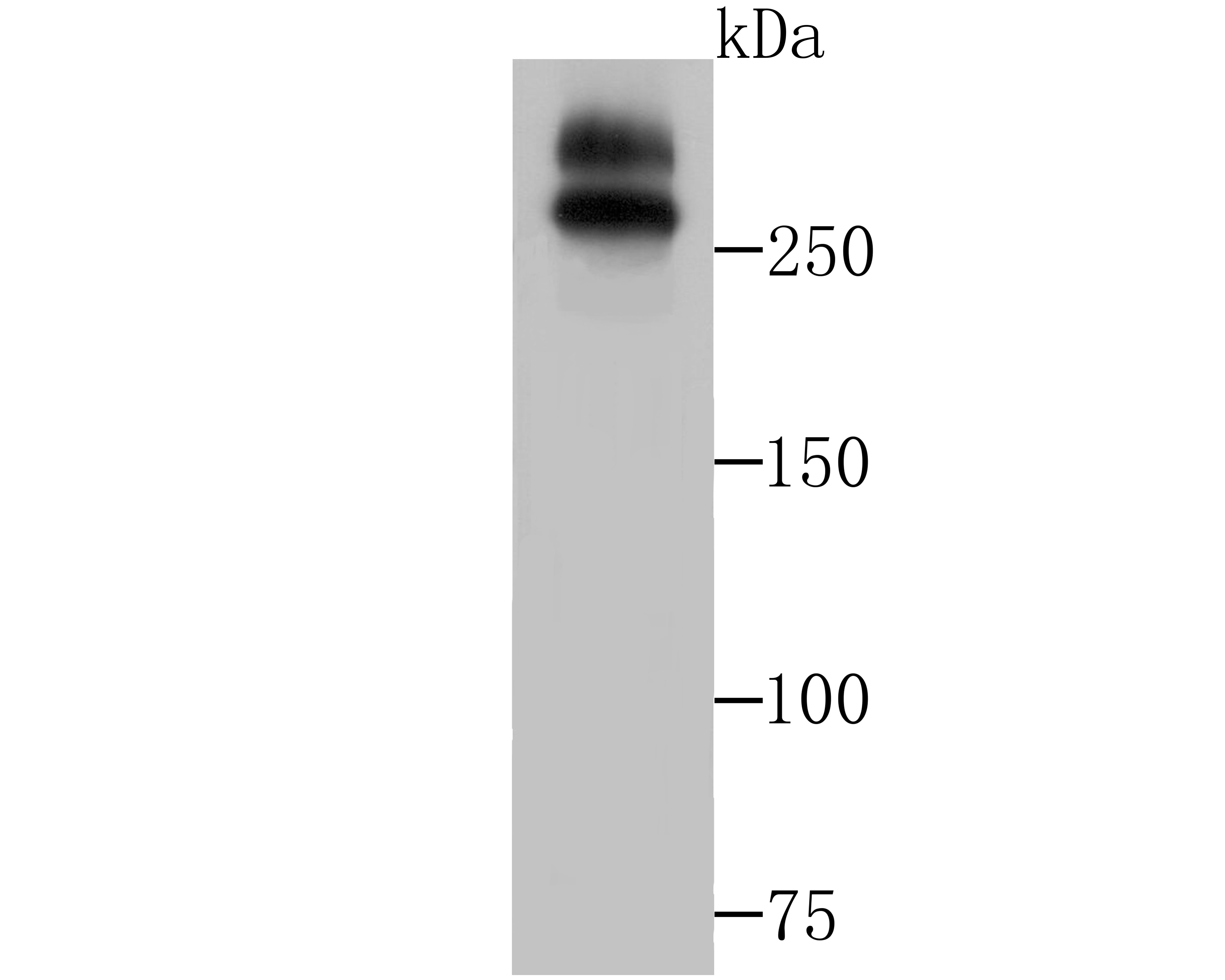 WNK1 Rabbit mAb