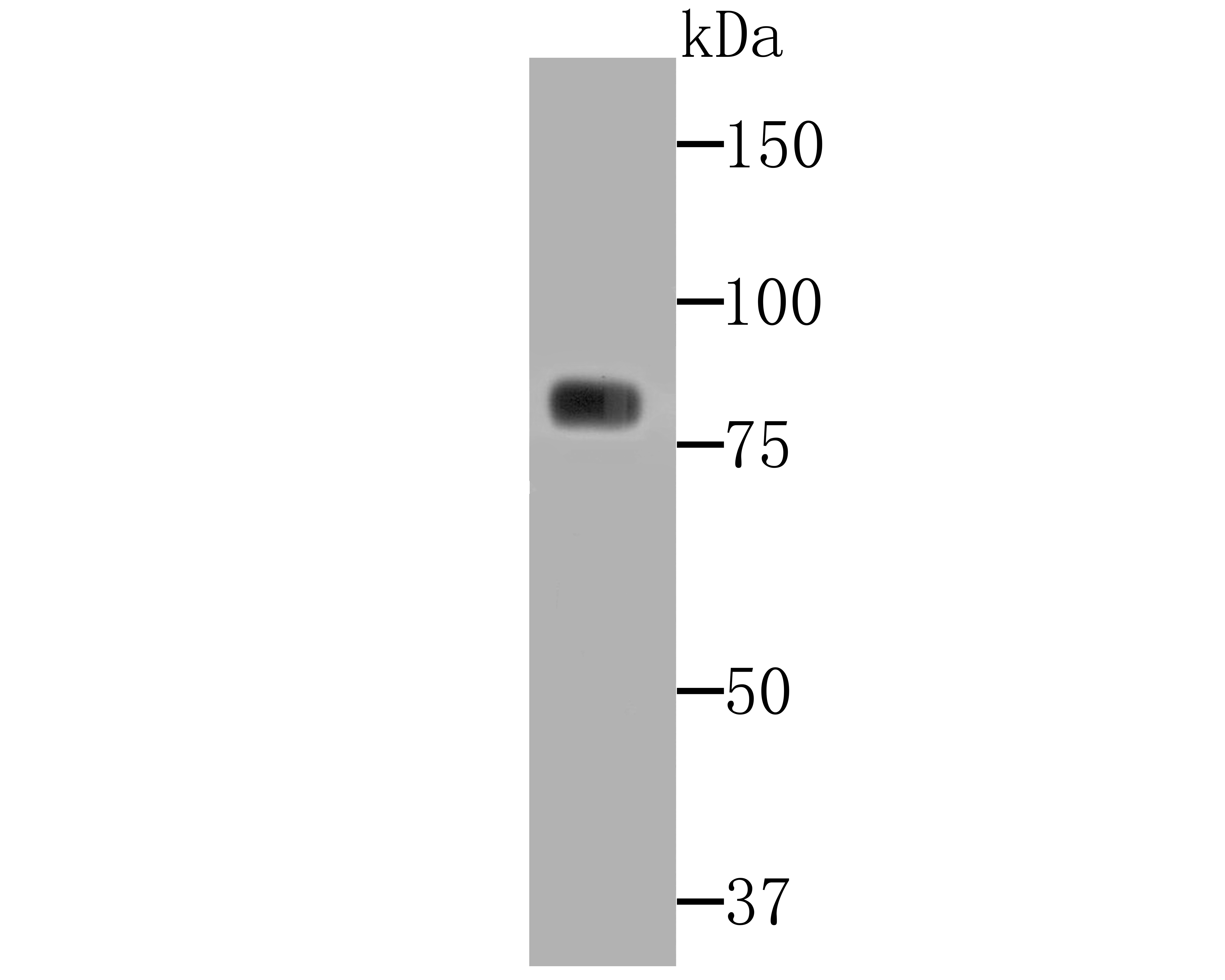 PKC gamma Rabbit mAb