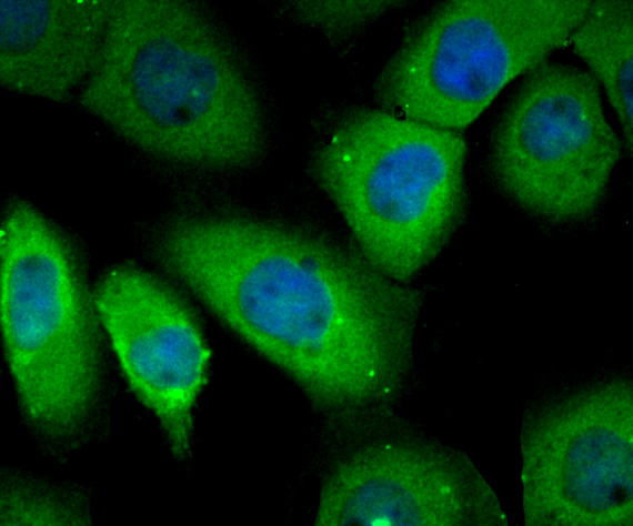 RHEB Rabbit mAb