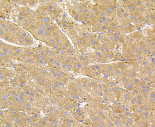 RHEB Rabbit mAb