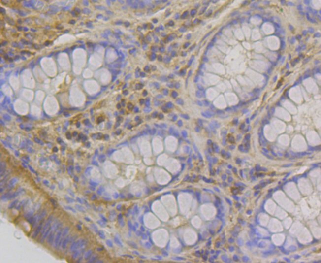 RHEB Rabbit mAb