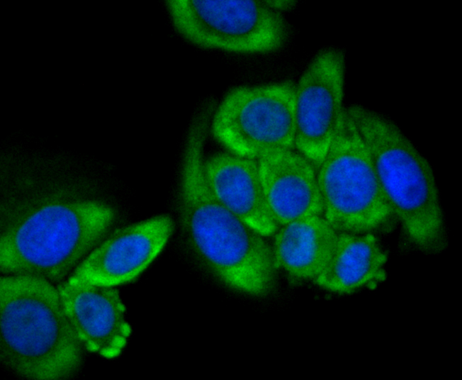 Tetranectin Rabbit mAb