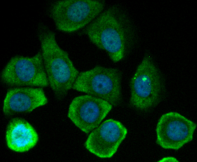 Tetranectin Rabbit mAb