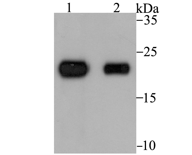 Tetranectin Rabbit mAb