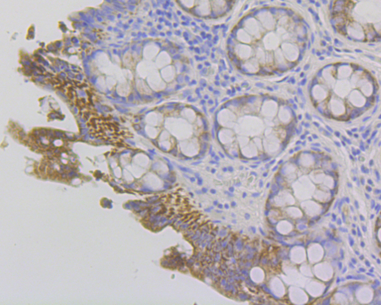 Fibrinogen gamma chain Rabbit mAb