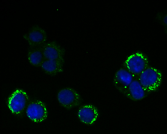 RanGAP1 Rabbit mAb