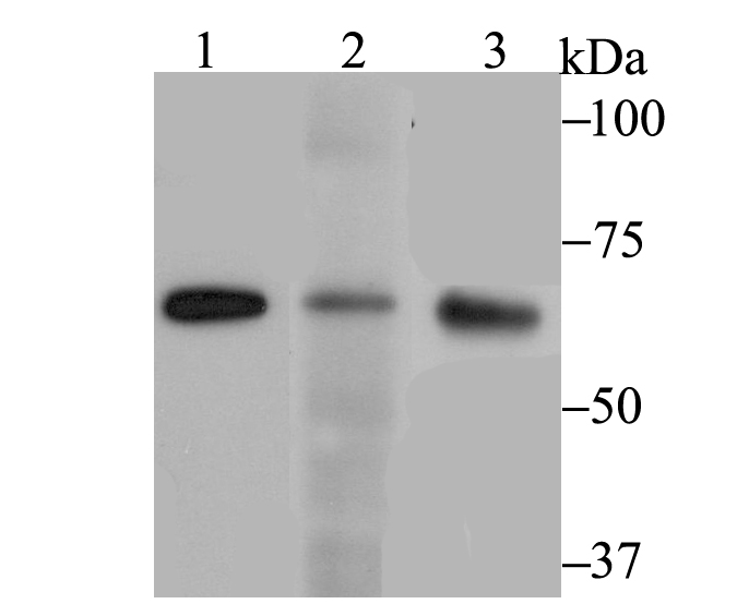 RanGAP1 Rabbit mAb