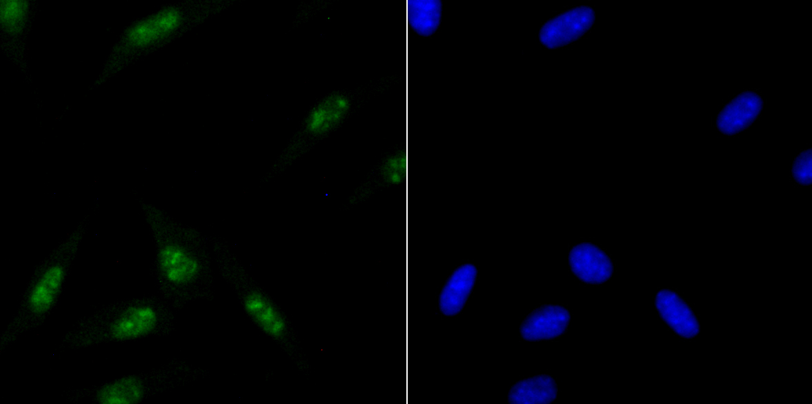 ILF3 Rabbit mAb