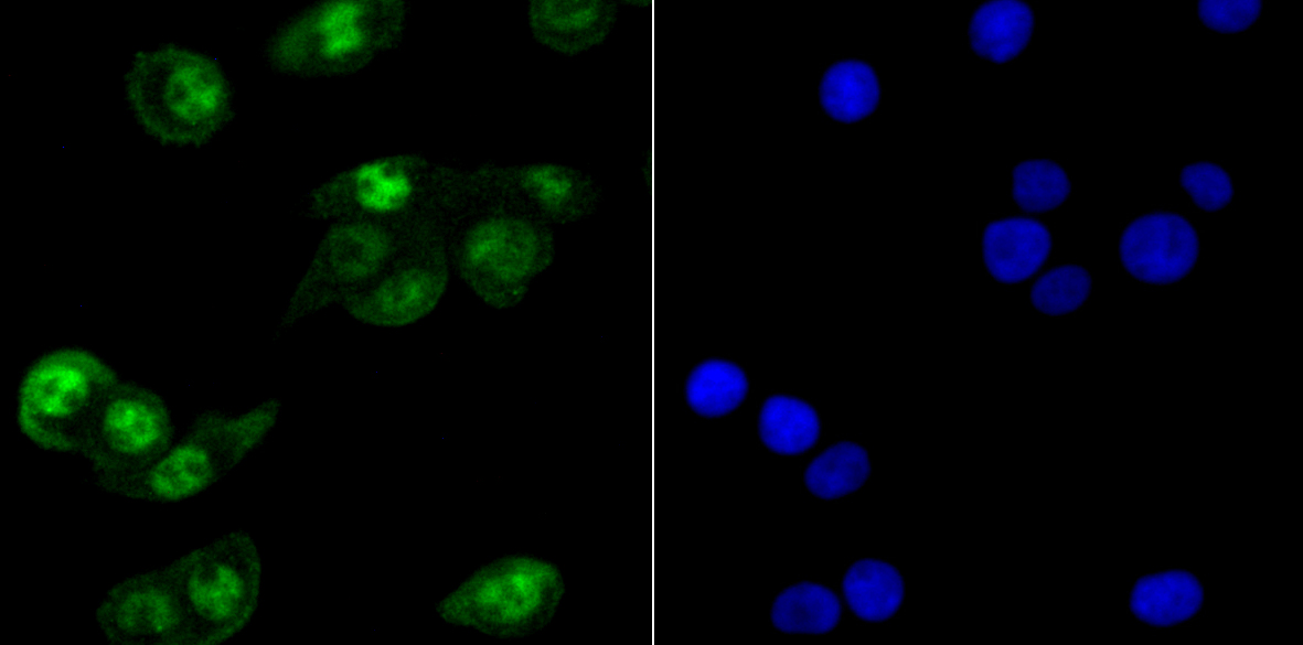 HIF1AN Rabbit mAb