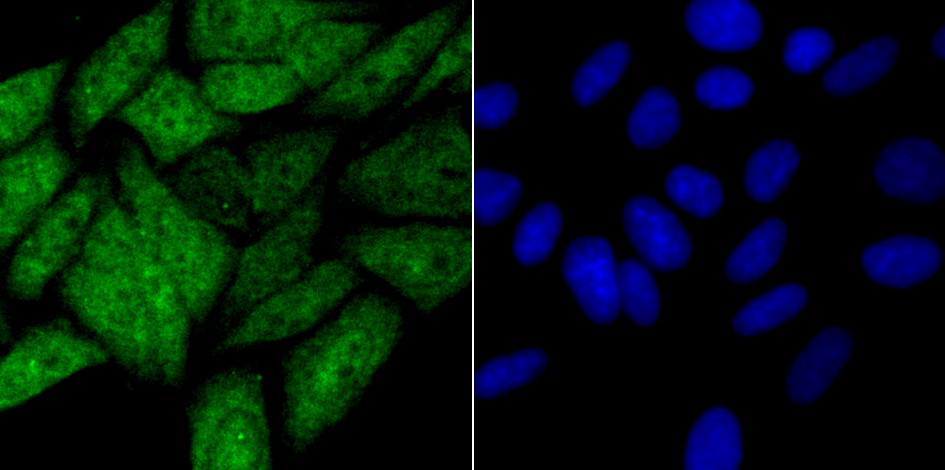 HIF1AN Rabbit mAb