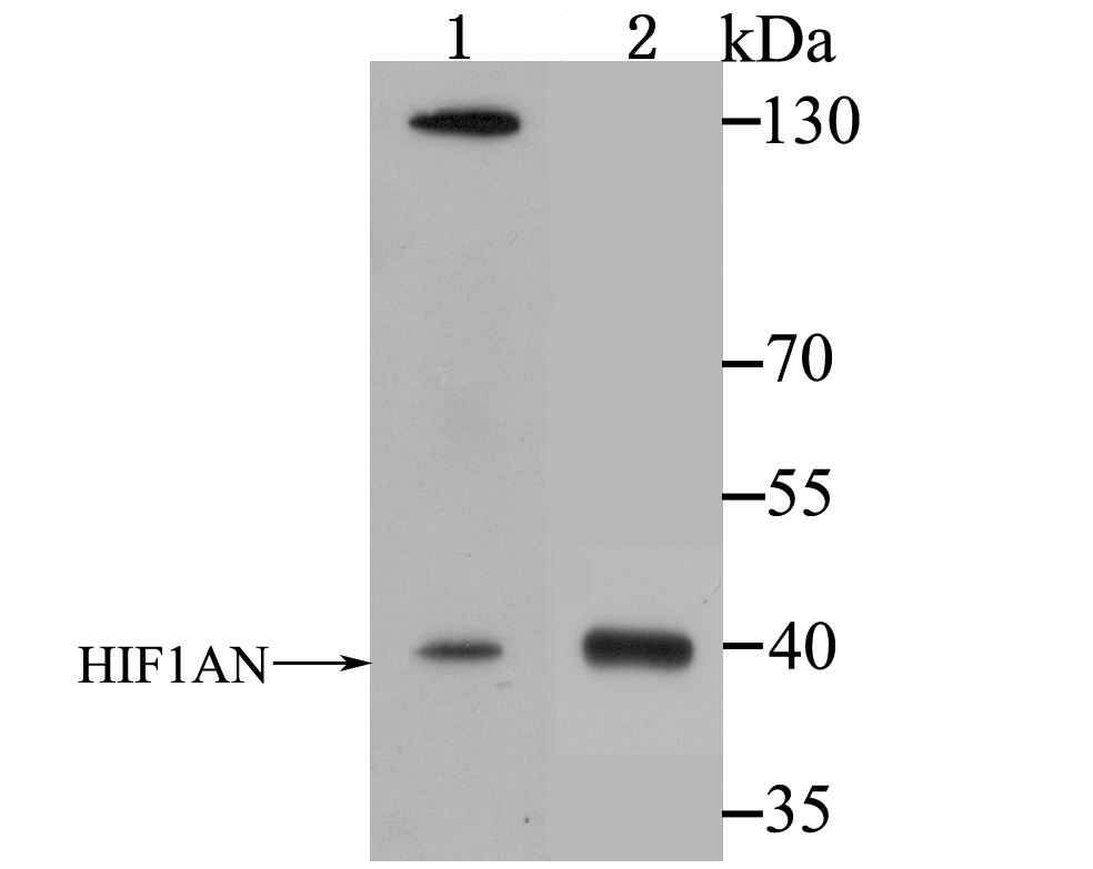 HIF1AN Rabbit mAb