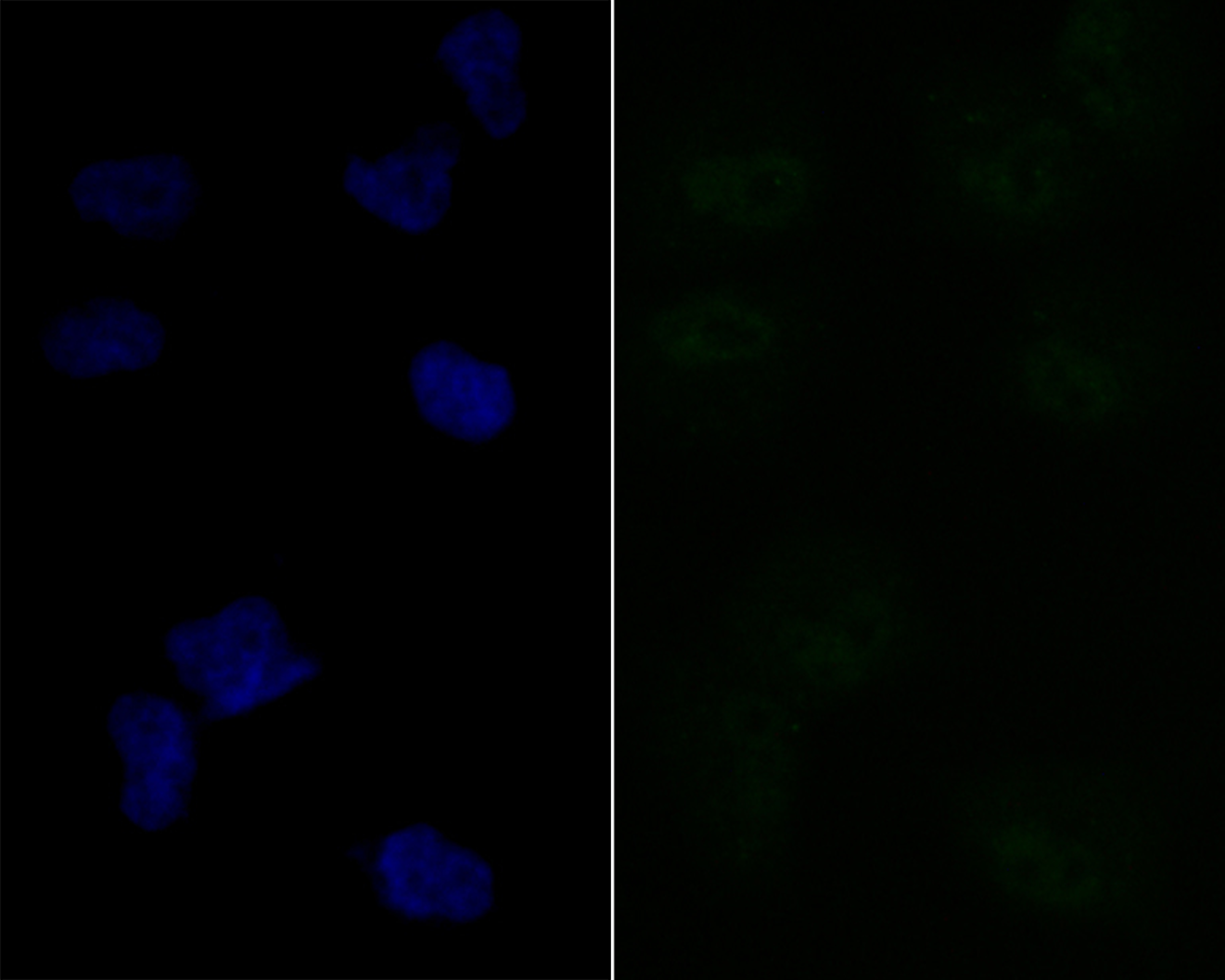 Lipin 1 Rabbit mAb