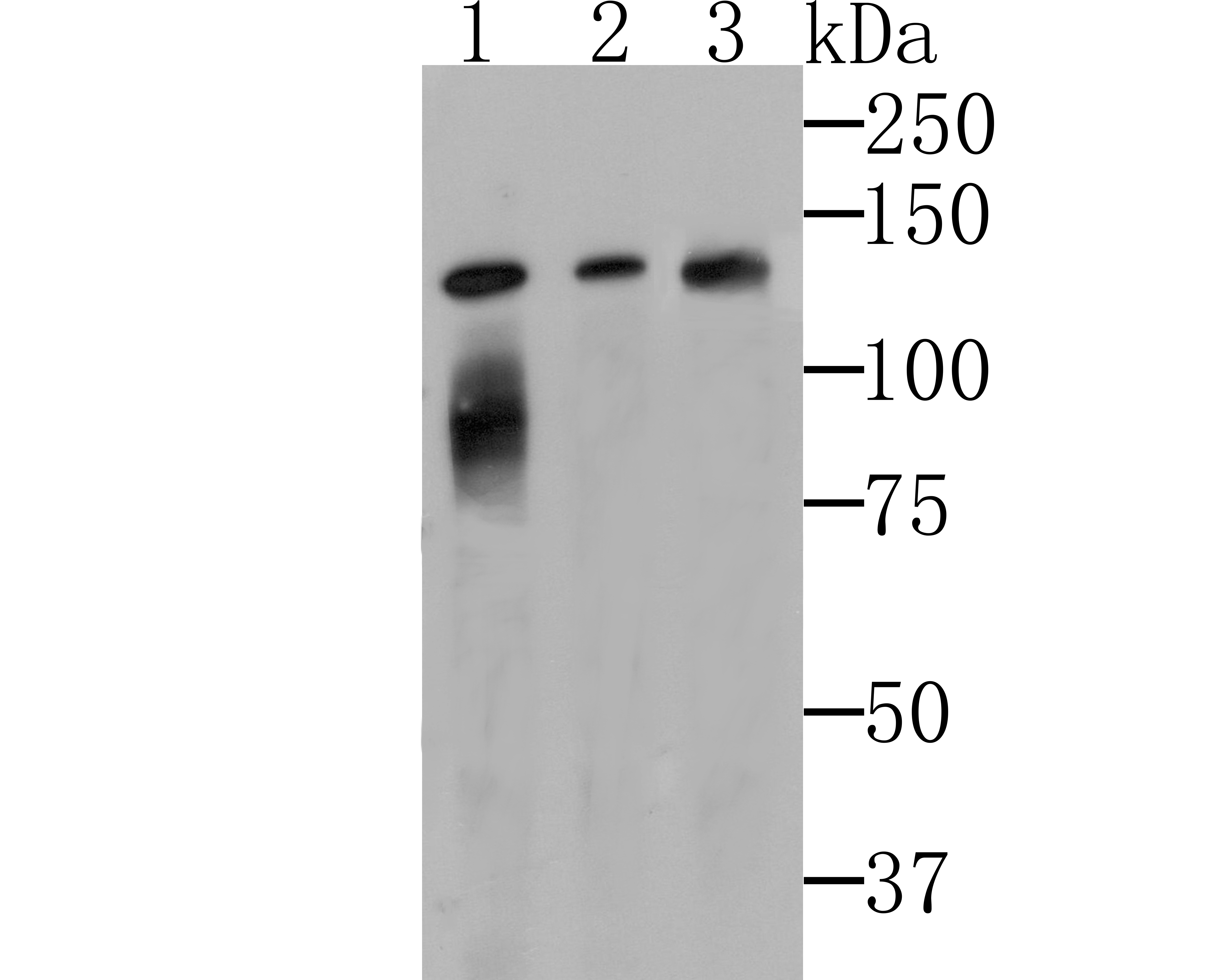 Lipin 1 Rabbit mAb