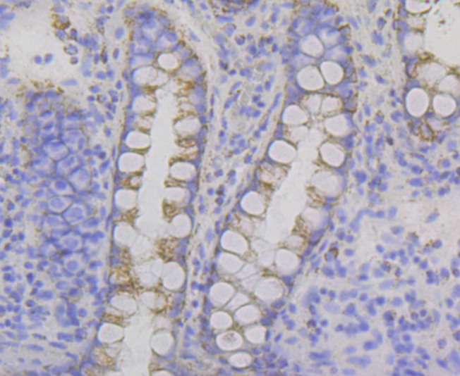 P2Y6 Rabbit mAb