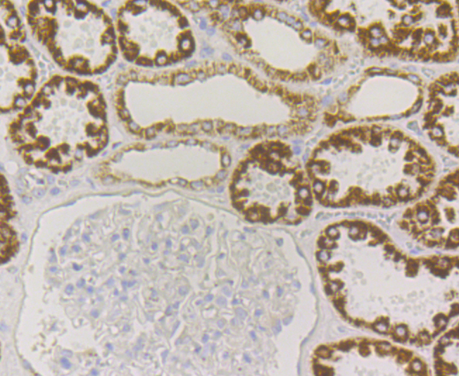 P2Y6 Rabbit mAb