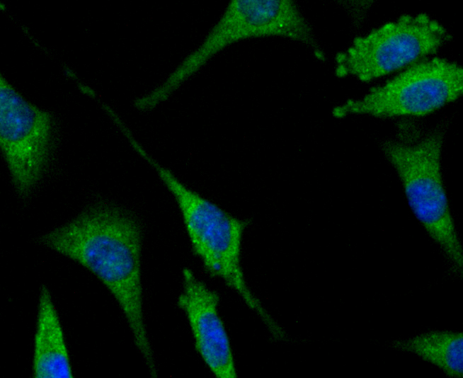 SENP1 Rabbit mAb