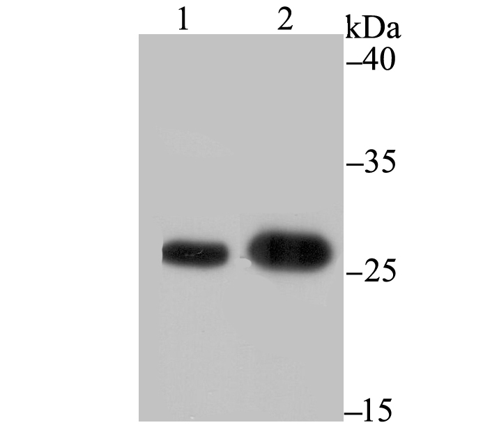 BAP31 Rabbit mAb