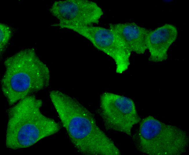 Annexin IV Rabbit mAb