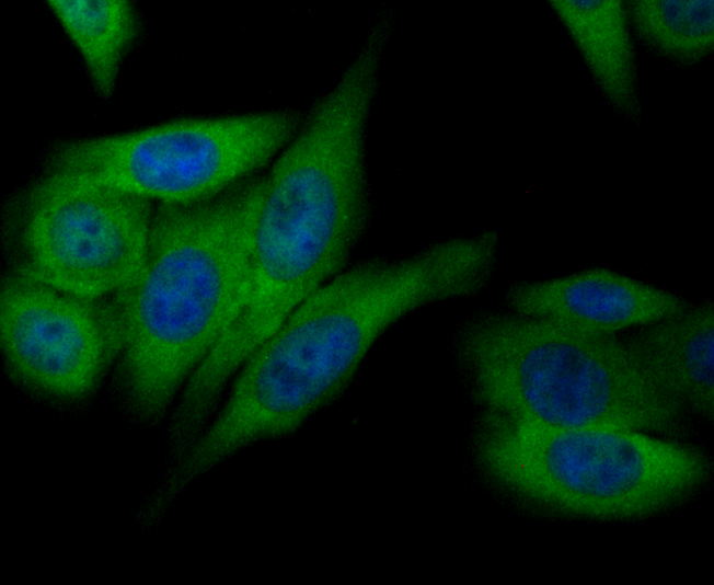 Annexin IV Rabbit mAb