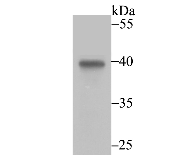 Annexin IV Rabbit mAb