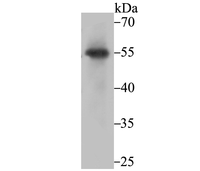 PIST Rabbit mAb