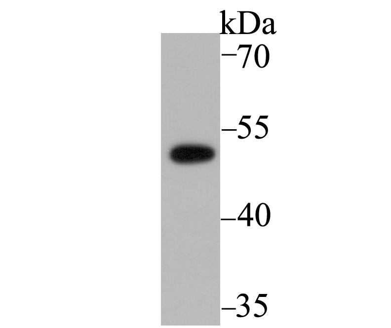 PICK1 Rabbit mAb