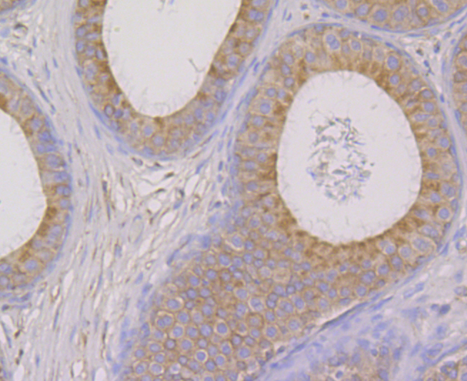 OS9 Rabbit mAb