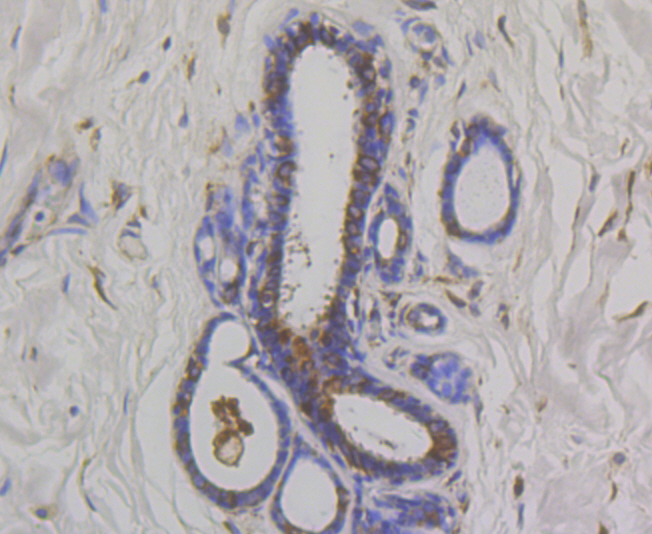 OS9 Rabbit mAb