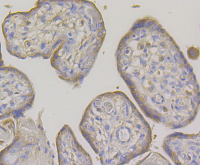 OS9 Rabbit mAb